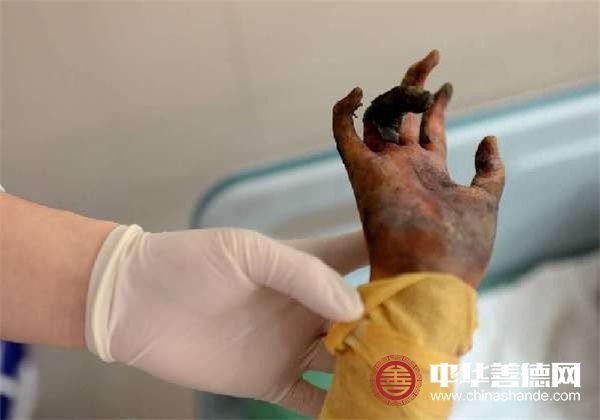 孩子在医院接受治疗 照片由西南医院提供.jpg